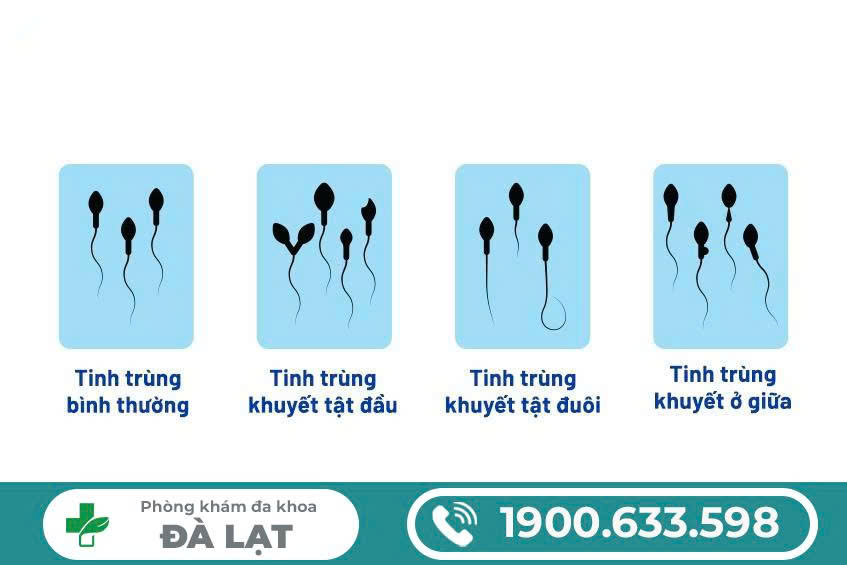 Hình ảnh minh họa